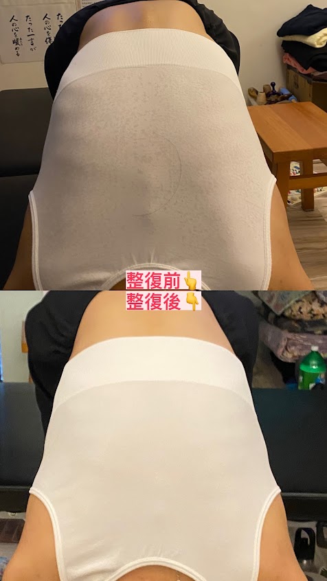 （電話預約）喜源整復調理、經絡淋巴、筋膜拉筋、正骨推拿養生工作室-30分鐘/$500