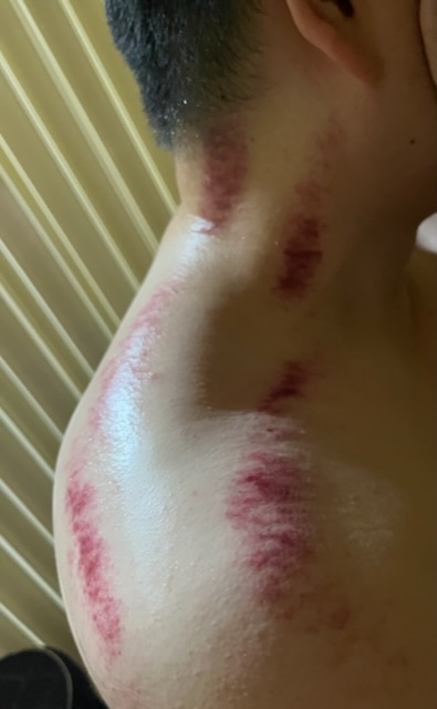 93美學 按摩SPA