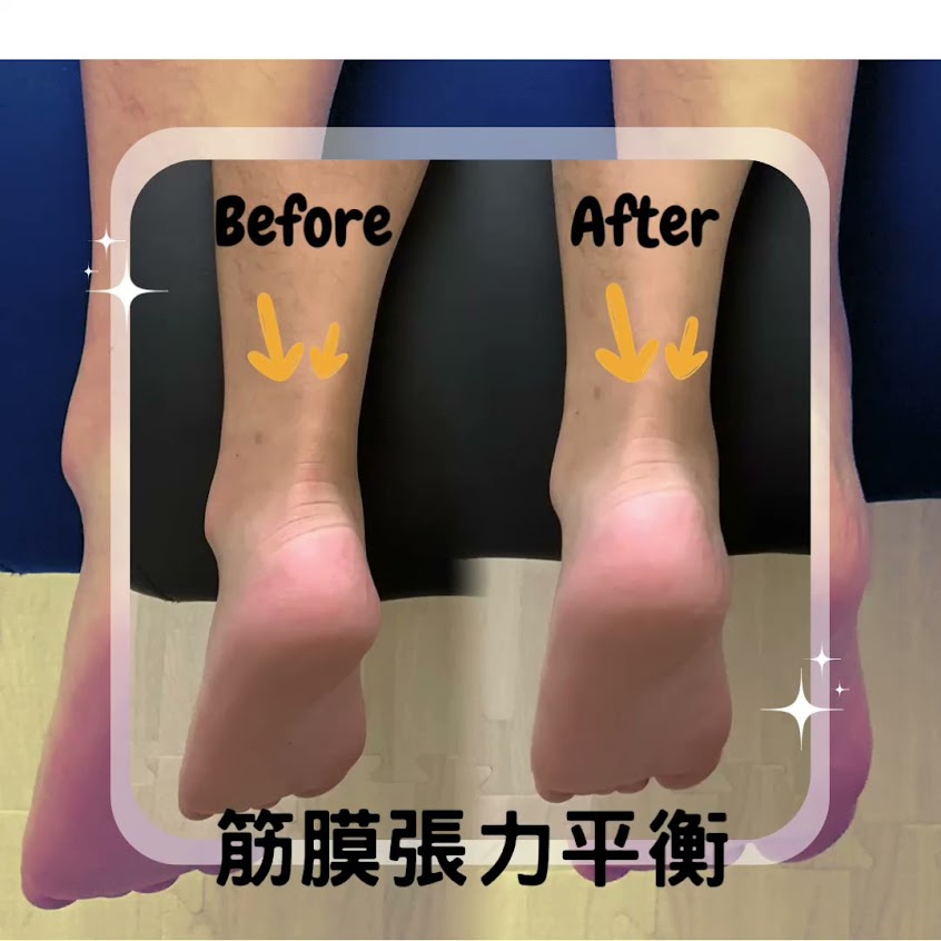 邦手運動按摩【請點下方網站預約】【運動按摩｜屏東按摩｜筋膜刀調理｜筋膜放鬆｜到府服務】