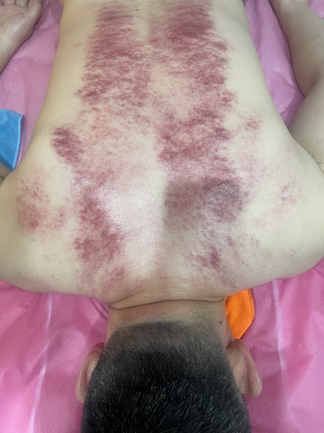金蓉泰式推拿