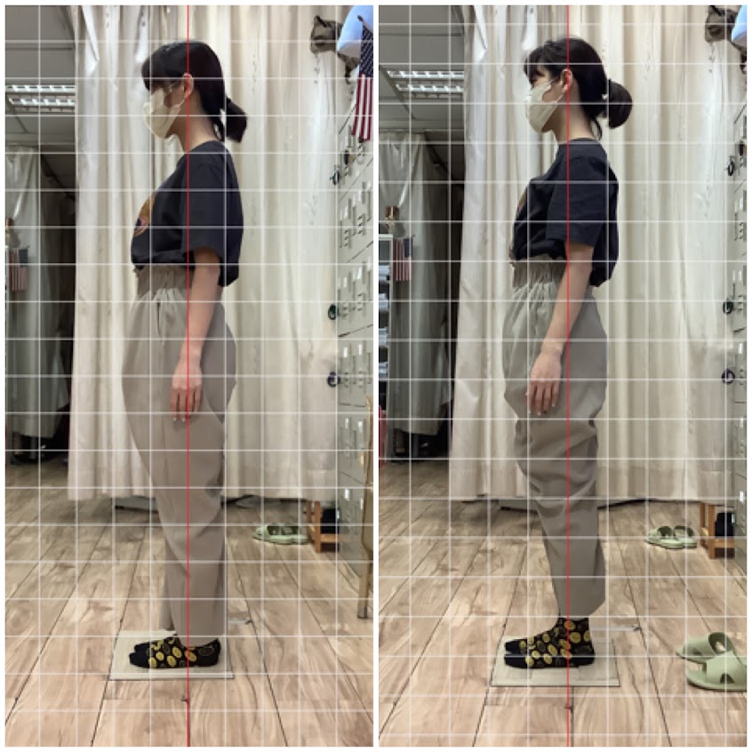 SPINEX湯普森X脊纖美式体態整復中心（桃園車站店）採預約制Chiropractic