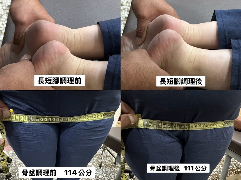 感恩整復館（正）採預約制-台中太平平價按摩|腰痛無痛整復|經絡按摩|指壓無痛整復| 調理骨盆|產後修復調整骨盆|產後無痛全身骨盆調理|鬆筋整復|整復推薦